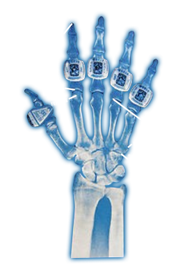 /products/overlays/38587704.png img